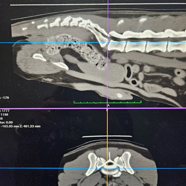 CT Scan Images