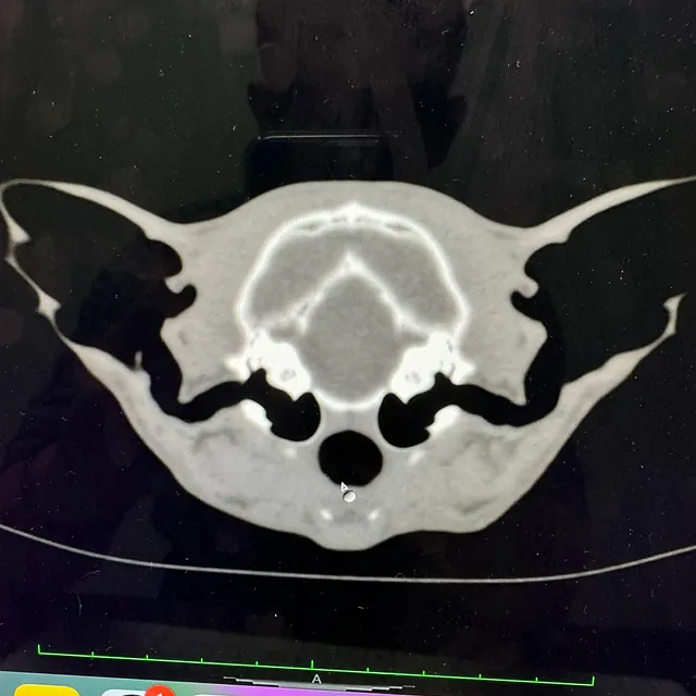 CT Scan Image
