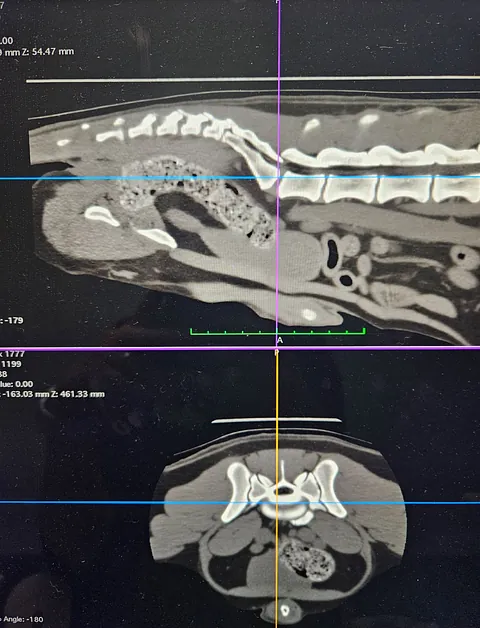 CT Scan Images